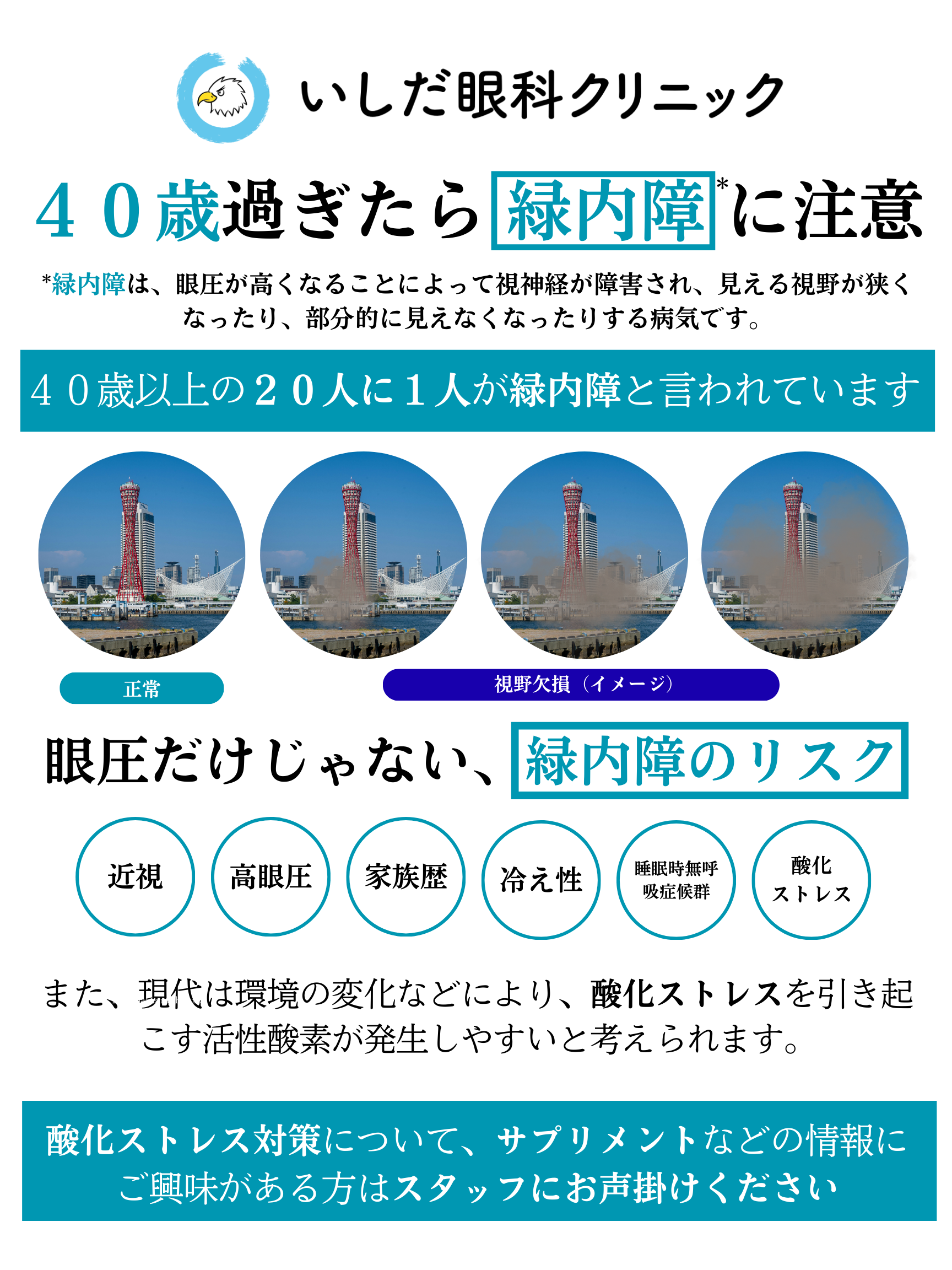 40歳過ぎたら緑内障に注意